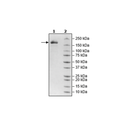 Spike Trimer (S1+S2) (B.1.1.7, Alpha Variant), His-Tag (SARS-CoV-2) Recombinant – Figure 1 of 1