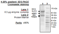 EZH2 (A677T)/EED/SUZ12/RbAp48/AEBP2, His-tag, FLAG-tag Recombinant – Figure 1 of 1