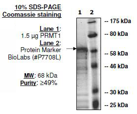 PRMT1, GST-Tag (E. coli-derived) Recombinant – Figure 1 of 2