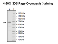 PRMT1, His-GST-tag (Sf9-derived) Recombinant – Figure 1 of 2
