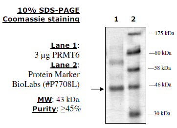 PRMT6, His-tag Recombinant – Figure 1 of 4