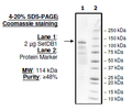 SetDB1, His-GST-tags Recombinant – Figure 1 of 2