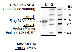 SUV4-20H2, GST-tag Recombinant – Figure 1 of 1