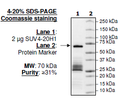 SUV4-20H1, GST-tag Recombinant – Figure 1 of 2