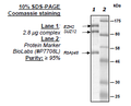 EZH2/SUZ12/RbAp48, His-GST-tags, His-tag Recombinant – Figure 1 of 1