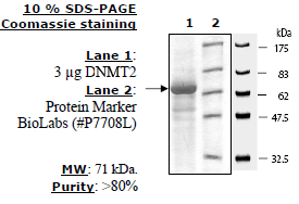 DNMT2, GST-tag Recombinant – Figure 1 of 1