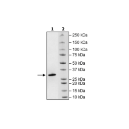 Histone H1, Full Length, His-tag Recombinant – Figure 1 of 1