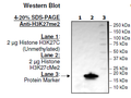 Histone H3 K27cMe2, Full Length, His-tag Recombinant – Figure 1 of 2