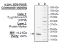 Histone H3 (K27M), His-tag Recombinant – Figure 1 of 1