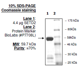 SETD2, GST-tag Recombinant – Figure 1 of 2