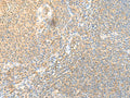 SSC4D Polyclonal Antibody – Figure 1 of 2