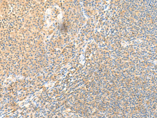 SSC4D Polyclonal Antibody – Figure 1 of 2