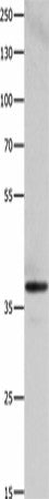 HMOX2 Polyclonal Antibody – Figure 1 of 2