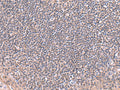 RIC8A Polyclonal Antibody – Figure 1 of 3