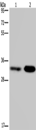 CDK5 Polyclonal Antibody – Figure 1 of 4
