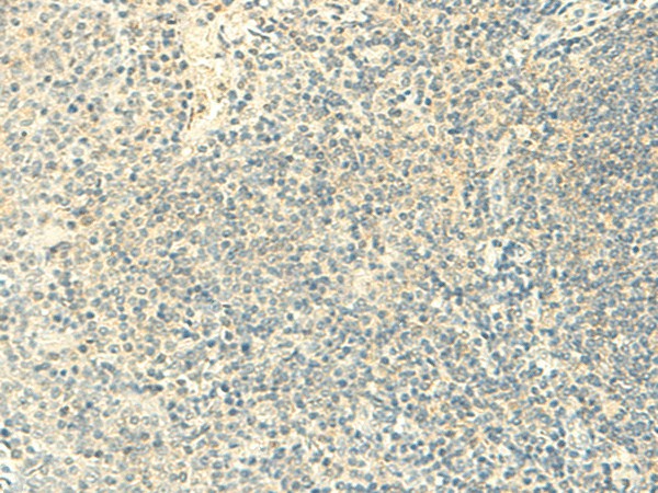 FMNL2 Polyclonal Antibody – Figure 1 of 2
