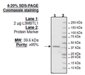 L3MBTL1, His-tag Recombinant – Figure 1 of 1