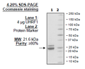 UHRF1 (108-286), His-tag Recombinant – Figure 1 of 1
