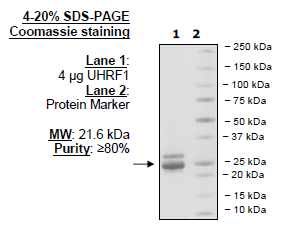 UHRF1 (108-286), His-tag Recombinant – Figure 1 of 1