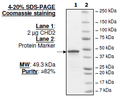 CHD2, GST-tag Recombinant – Figure 1 of 1