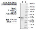 CDY1, GST-tag Recombinant – Figure 1 of 1
