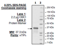 CBX2, GST-tag Recombinant – Figure 1 of 1