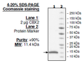 CBX2, His-tag Recombinant – Figure 1 of 1