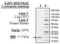CDY1, His-tag Recombinant – Figure 1 of 1