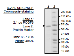 PCGF6, GST-tag Recombinant – Figure 1 of 1