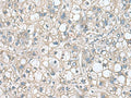 RHBDL2 Polyclonal Antibody – Figure 1 of 2