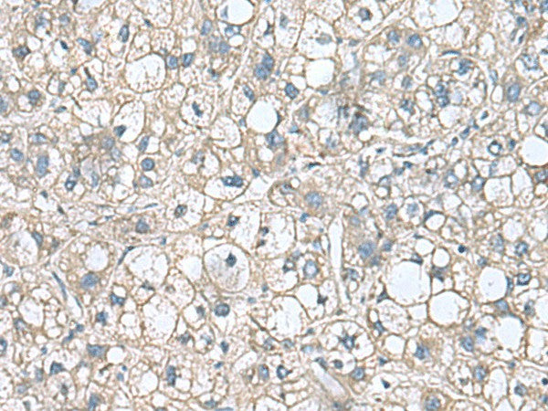 RHBDL2 Polyclonal Antibody – Figure 1 of 2