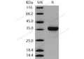 Recombinant Human KLK-8/Kallikrein-8 Protein (His Tag) – Figure 1 of 2