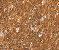 DAB2IP Polyclonal Antibody – Figure 1 of 3