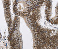 CMTM2 Polyclonal Antibody – Figure 1 of 3