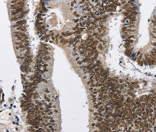 CMTM2 Polyclonal Antibody – Figure 1 of 3