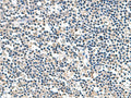 ATP5F1D Polyclonal Antibody – Figure 1 of 2