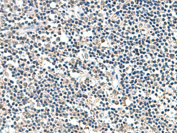 ATP5F1D Polyclonal Antibody – Figure 1 of 2