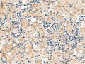 DUSP7 Polyclonal Antibody – Figure 1 of 2