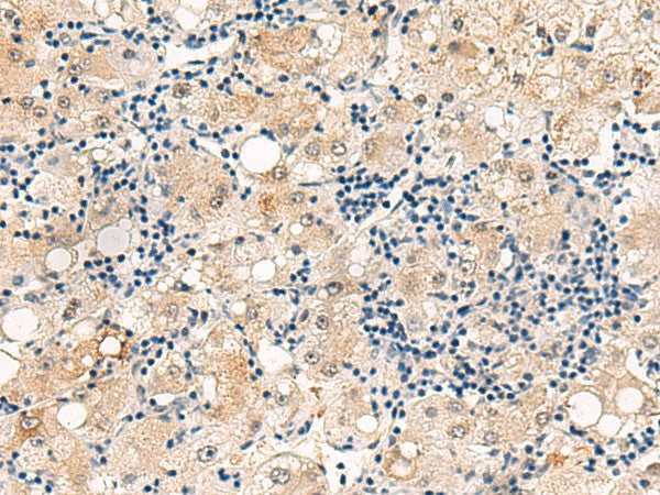 DUSP7 Polyclonal Antibody – Figure 1 of 2