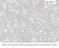 Immortalized Oral Cancer Associated Fibroblast Cell Line (UM-SCC-124-CAF) | Applied Biological Materials (abm)