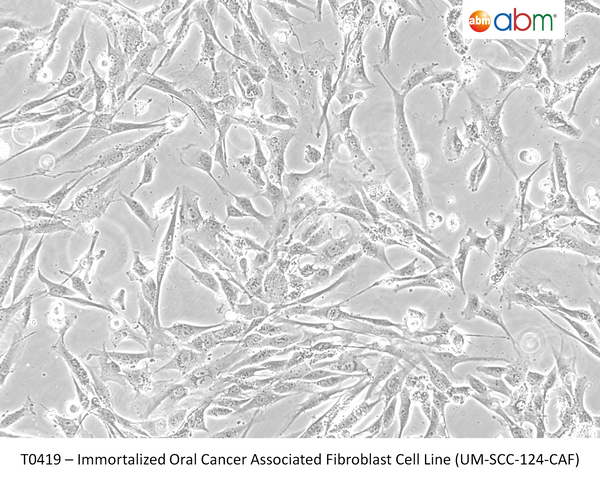 Immortalized Oral Cancer Associated Fibroblast Cell Line (UM-SCC-124-CAF) | Applied Biological Materials (abm)
