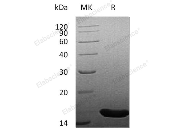 Recombinant Human FGF-4/FGF4 Protein – Figure 1 of 2
