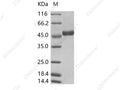 Recombinant ZIKV (strain Zika SPH2015) NS1 Protein (C-His Tag) - Figure 1 of 2