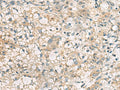 RTP4 Polyclonal Antibody – Figure 1 of 2