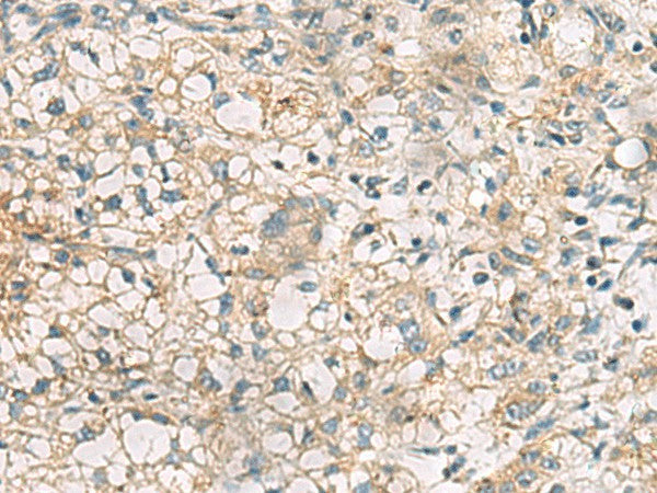 RTP4 Polyclonal Antibody – Figure 1 of 2