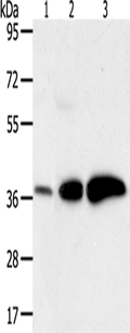 AKR1C1 Polyclonal Antibody – Figure 1 of 4