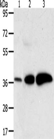 AKR1C1 Polyclonal Antibody – Figure 1 of 4