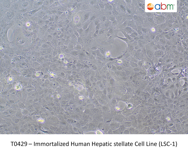 Immortalized Human Hepatic stellate Cell Line (LSC-1) – Figure 1 of 1