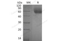 Recombinant Mouse IL1RL1/ST2 Protein (His Tag) – Figure 1 of 2