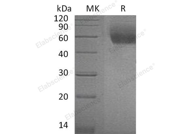 Recombinant Mouse IL1RL1/ST2 Protein (His Tag) – Figure 1 of 2